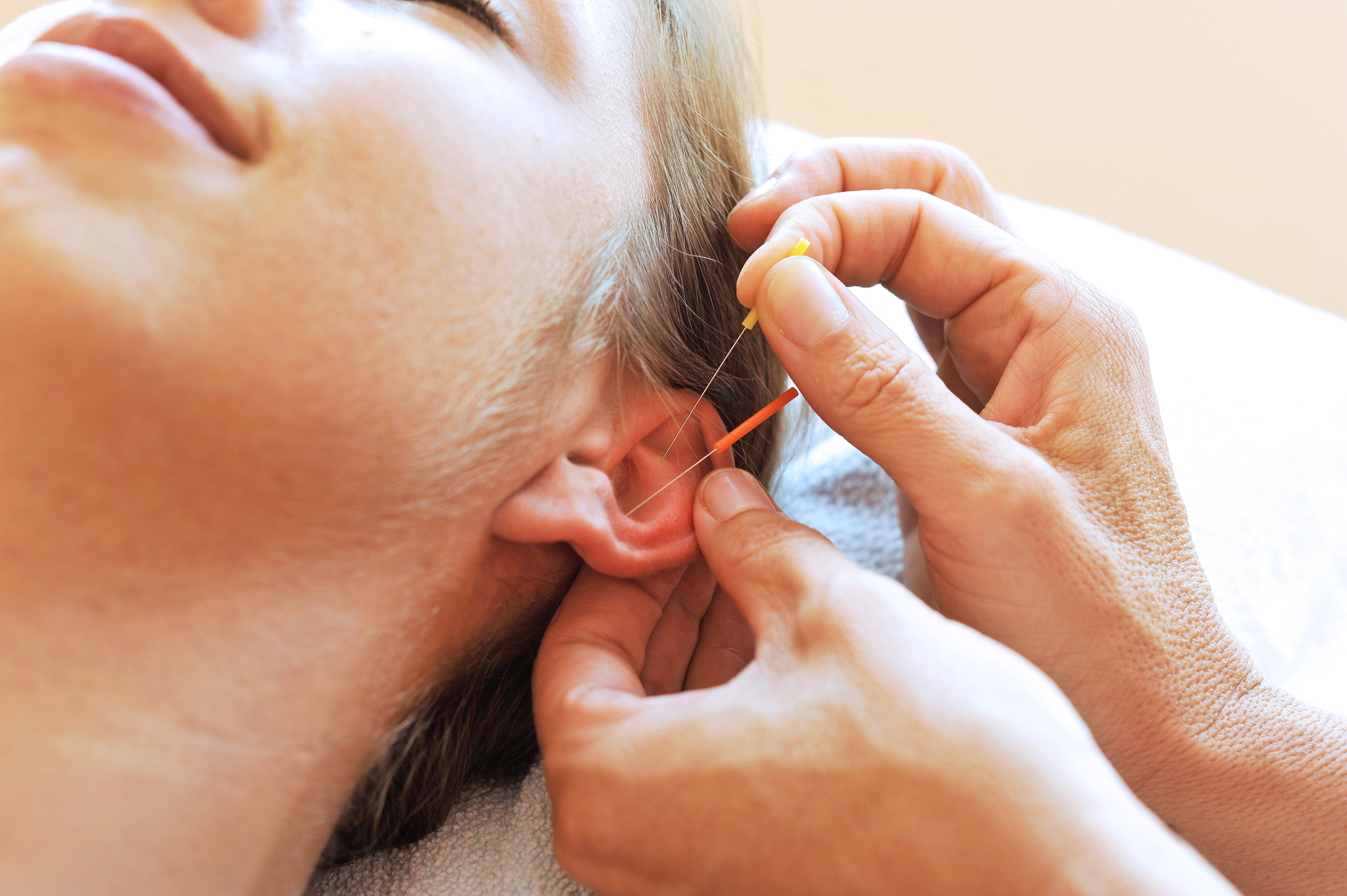 Akupunktur im Ohr